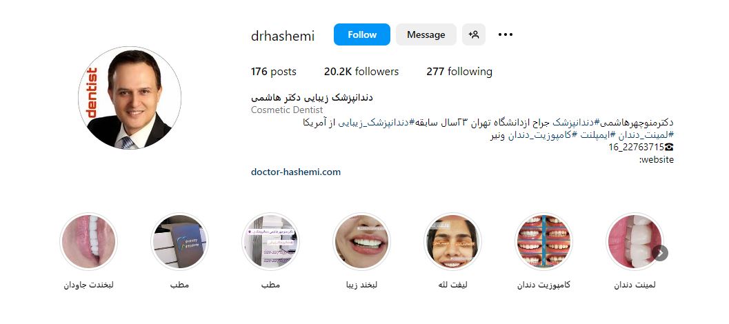 لمینت دندان در تهران مطب دکتر هاشمی 